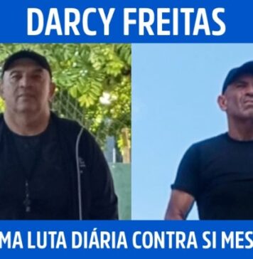 “É uma luta diária contra si mesmo”, diz professor que perdeu 50 kg após cirurgias no quadril